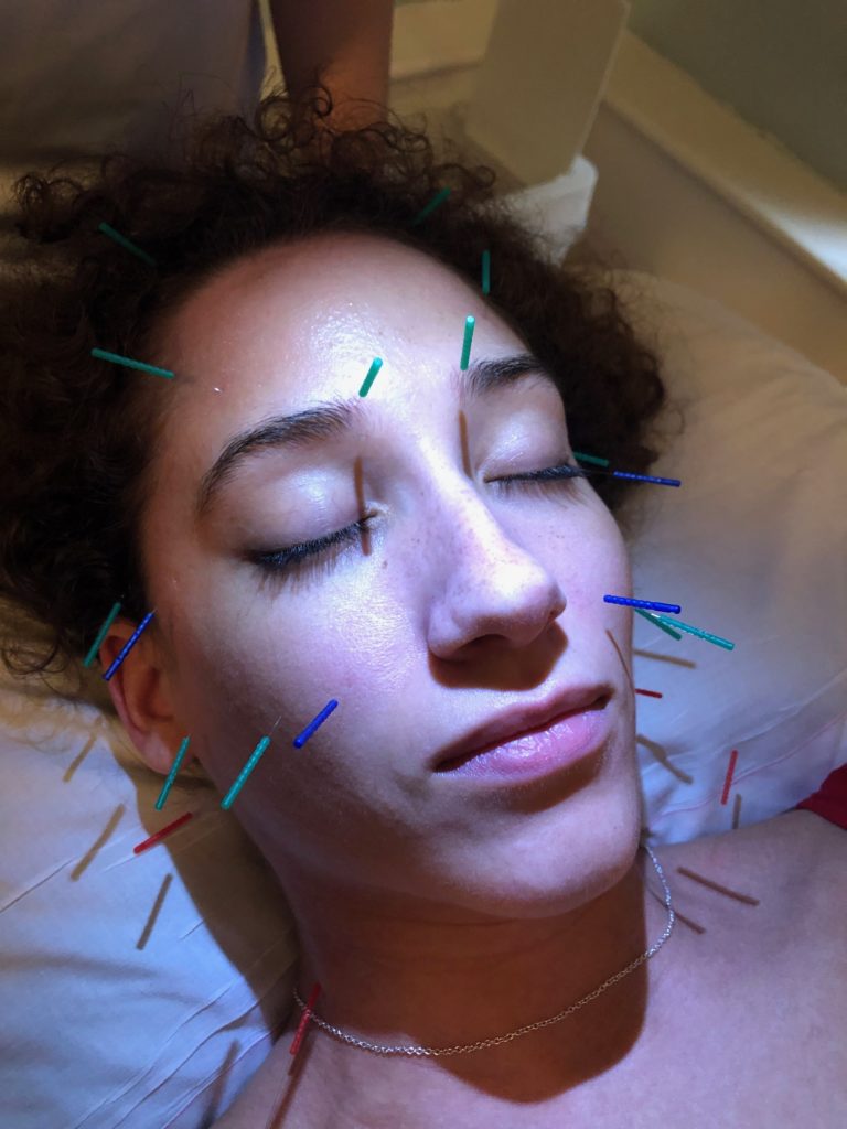 Facial rejuvenation acupuncture pricing